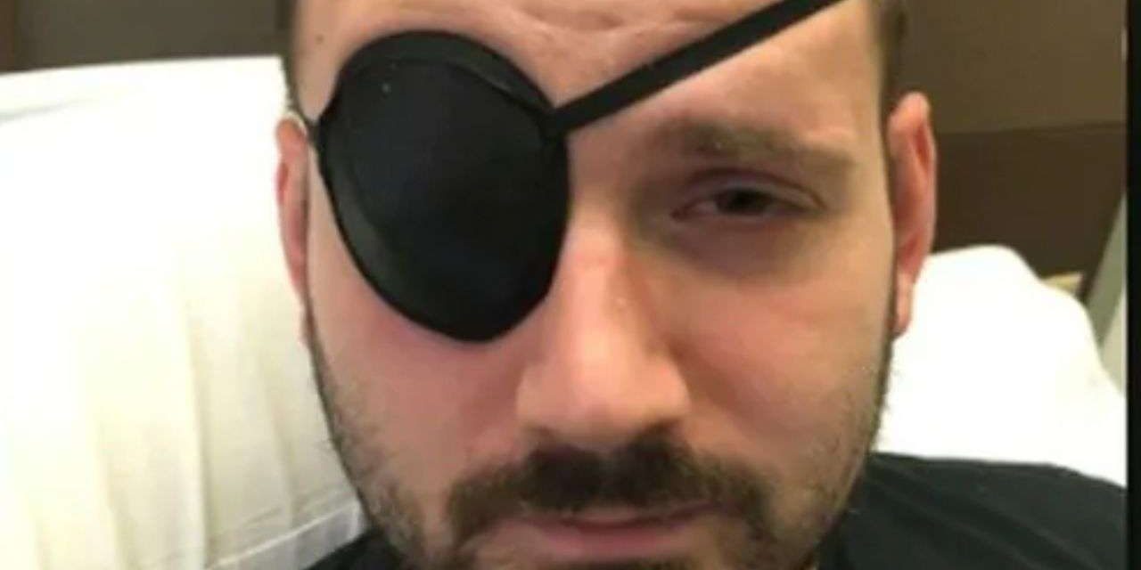 Estirar el cuello le provoca derrame cerebral