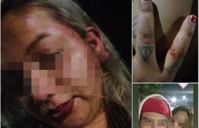 ‘Me quiere cortar en pedacitos’ Denuncia mujer intento de feminicidio en Saltillo