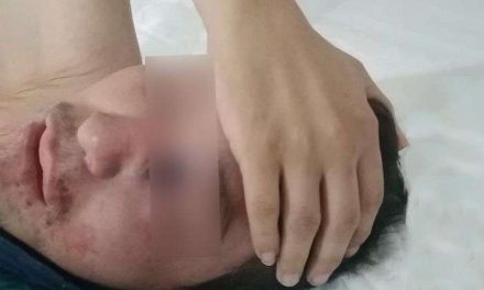 Muere Gregorio; el primer caso de hongo negro en México