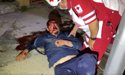 Motociclista se abre la cabeza al chocar contra poste