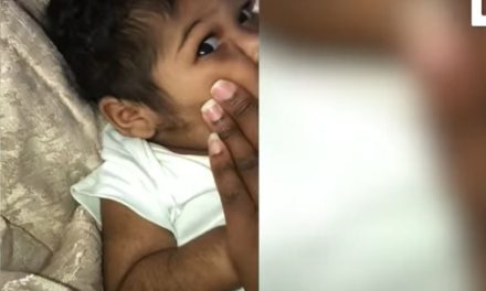 Mujer muestra como su bebé esta cubierta de vello