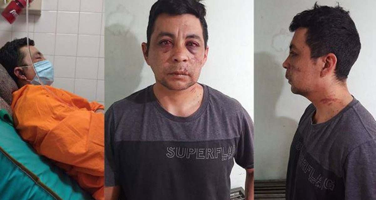 Muere enfermero que fue atacado por sus vecinos al contagiarse de covid