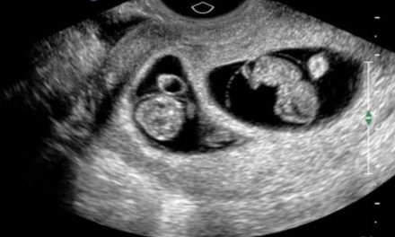 Provocan un aborto y matan por error a feto sano luego de confundirlo con gemelo enfermo en Reino Unido