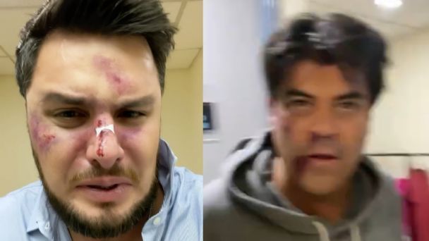 Paul Stanley apareció “golpeado” en un video de Instagram: ¿qué le pasó?