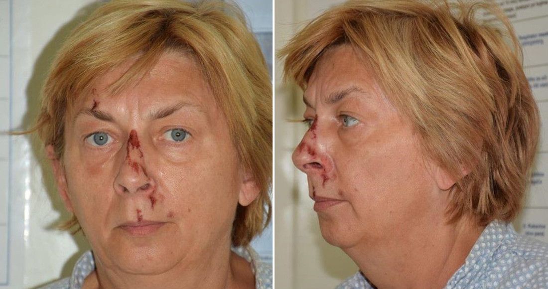 Mujer es hallada en una isla poblada por osos en Croacia; no sabe cómo llegó ahí