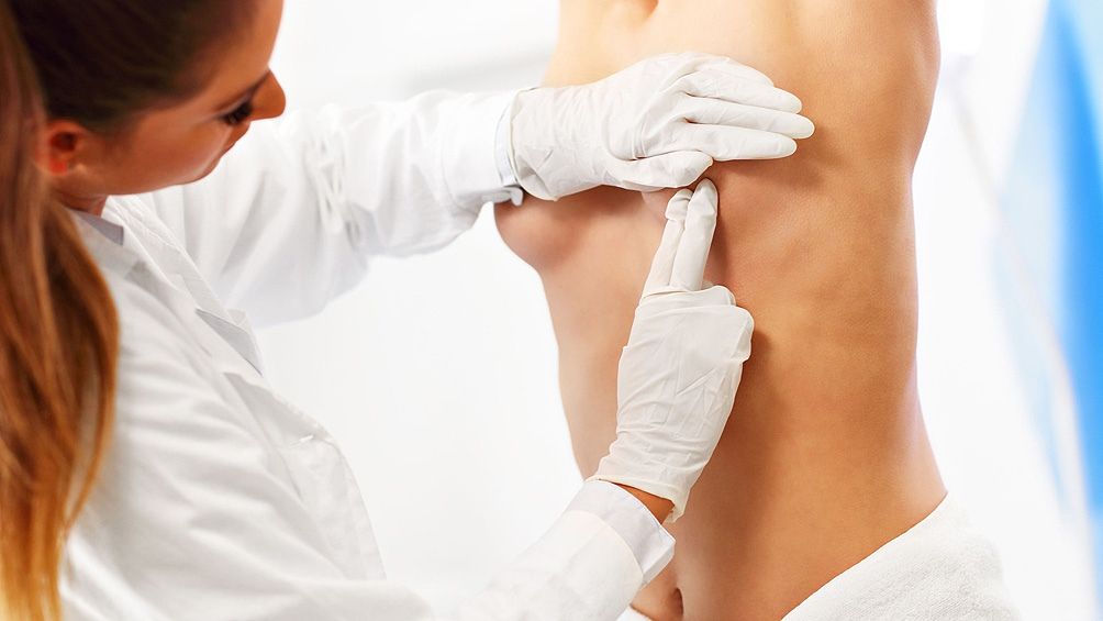 Estos son los síntomas del cáncer de mama que no conocías