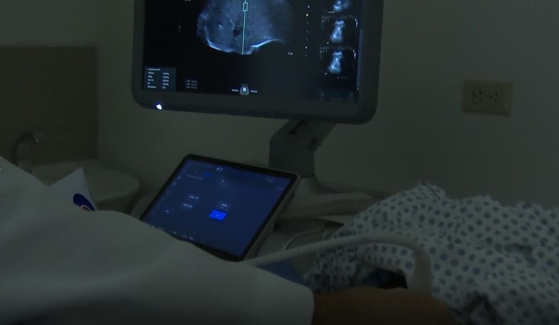 Realizan jornada de detección de cáncer hepático en Saltillo