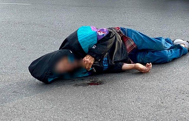 Atropellan a abuelito en las calles de Saltillo y muere al llegar al hospital