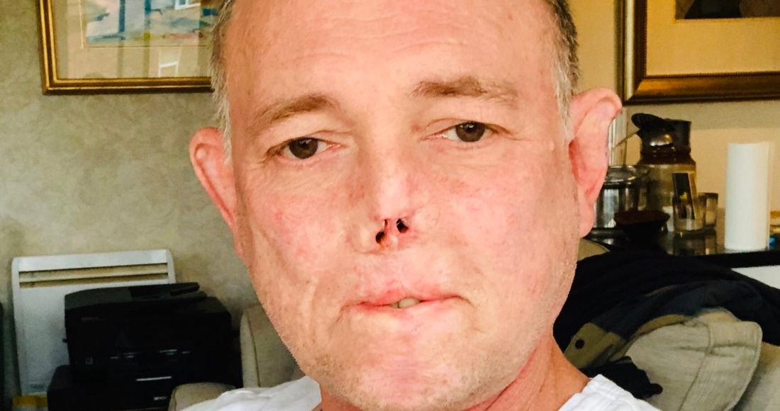 Doctor pierde sus piernas, dedos y parte de su rostro por la lamida de su perro