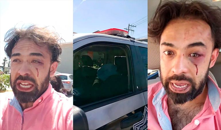 Por supuestas infidelidades, médico saltillense entra a cafetería al norte de Saltillo y golpea a otro hombre (Video)
