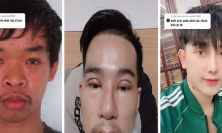Viral: No conseguía trabajo por feo, se hizo 9 cirugías y ahora es un famoso Tiktokero
