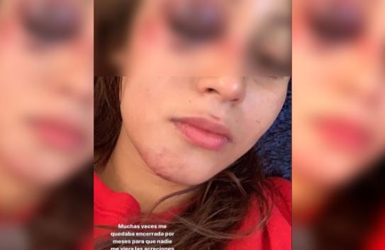 Denuncia influencer Sam Barrios a su expareja por violencia