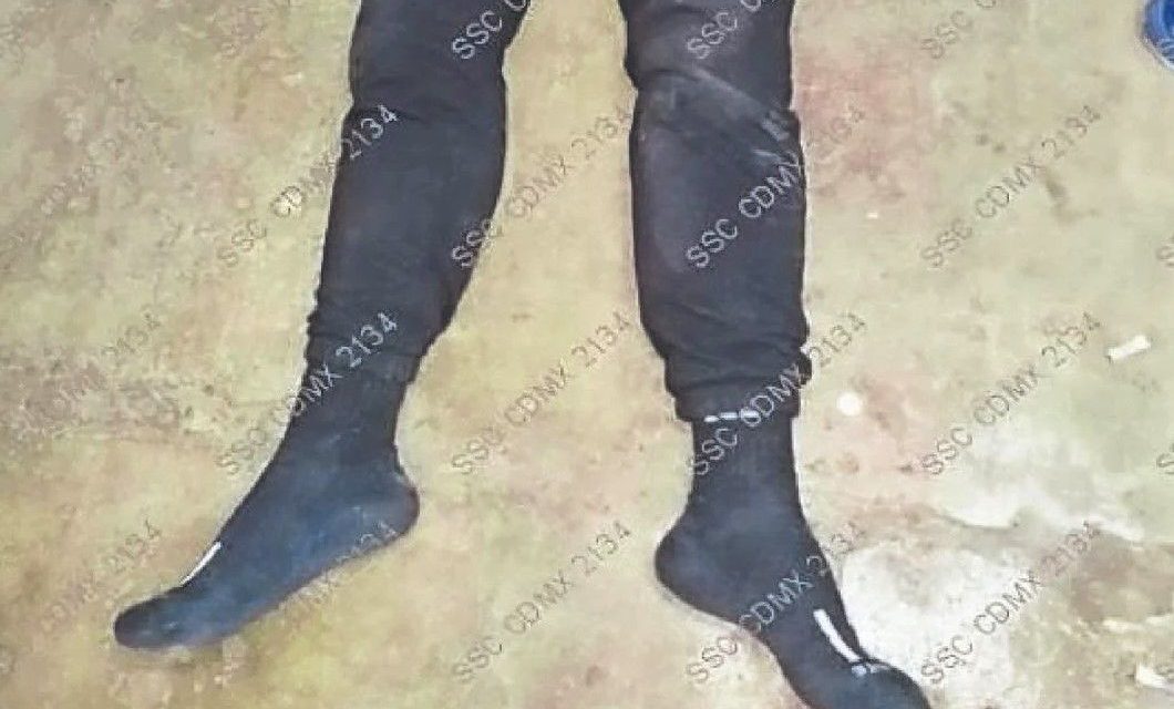 Hombre pellizca los cachetes de su prima y su novio lo golpea… minutos después muere frente a su madre