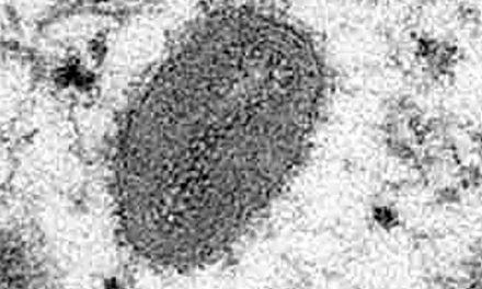 Así luce el virus de la viruela del mono en el microscopio