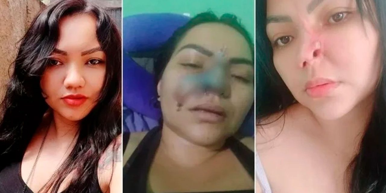 Contrata a dentista en internet para operarse nariz y le desfigura el rostro