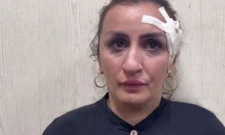 Mujer necesitaba una operación de nariz y decide vender a su hijo recién nacido