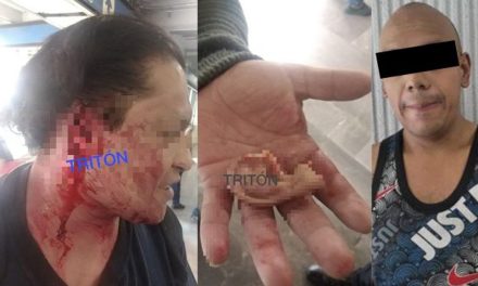 Hombre se cree Mike Tyson y le arranca la oreja a un usuario en el metro de la CDMX