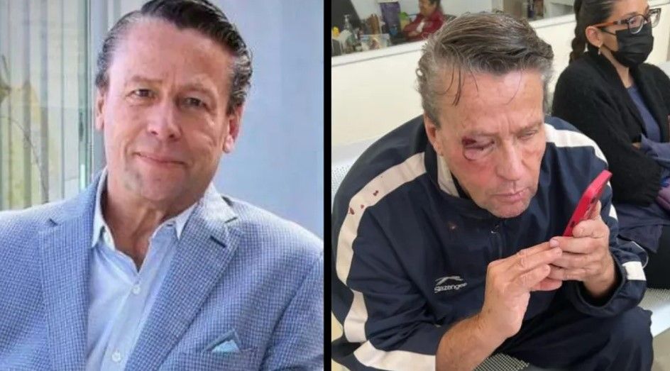 Alfredo Afame fue brutalmente golpeado por unos ‘malandros’