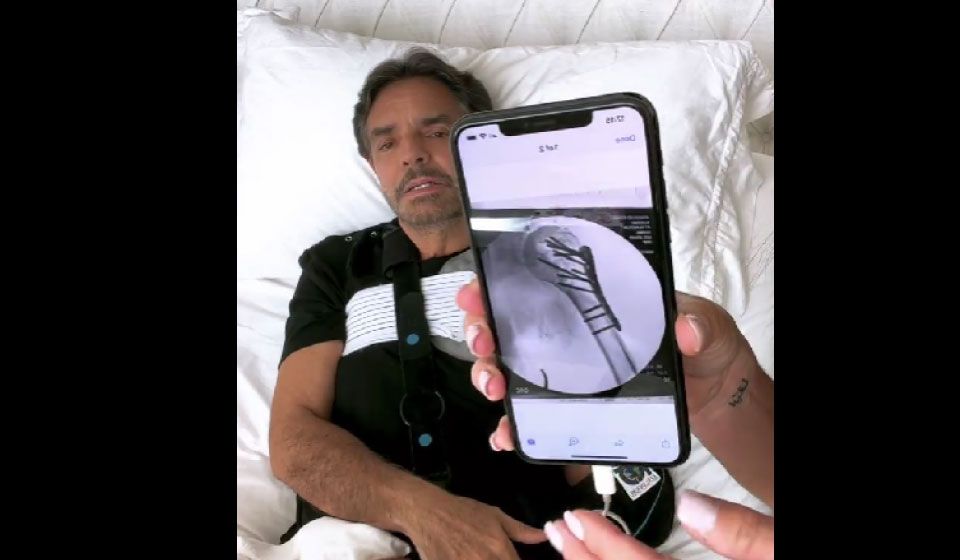 Influencer asegura que lesión de Eugenio Derbez se debió a una pelea