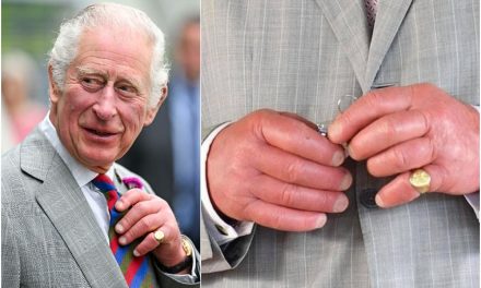 La razón por la que el rey Carlos III tiene ‘dedos de salchicha’