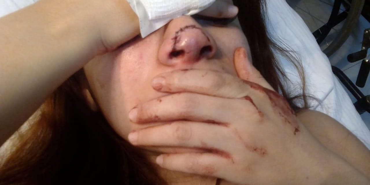 Condenan agresión contra joven madre de familia de Saltillo; expareja le dostrozó la nariz