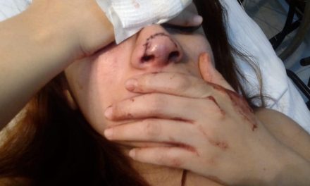 Condenan agresión contra joven madre de familia de Saltillo; expareja le dostrozó la nariz