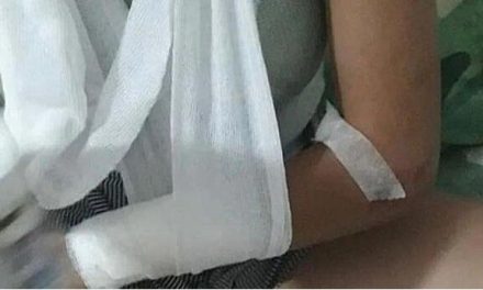 Joven fue secuestrada y escapa al lanzarse por la ventana de un auto en movimiento