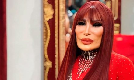 Lyn May presume nuevo rostro tras cirugía a sus 70 años