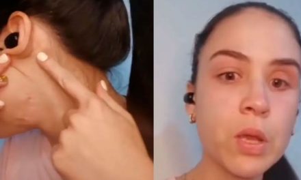 Mujer cuenta cómo sobrevivió a un secuestro y a un disparo en el rostro