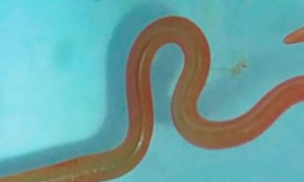 Hallazgo Impactante: Encuentran gusano vivo en el cerebro de mujer en Australia