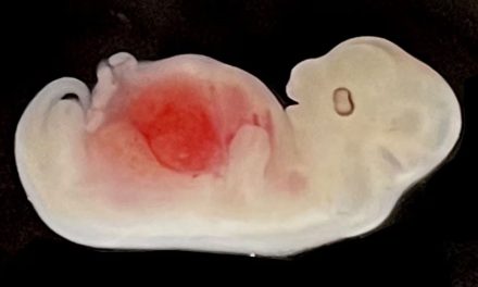 Logran científicos crear un órgano humano en un cerdo