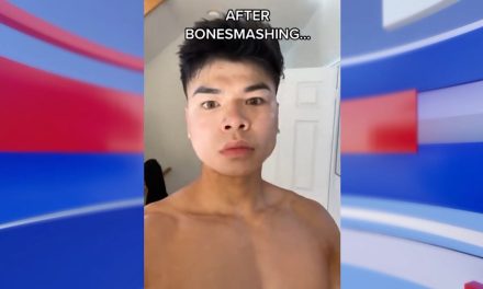 Bone Smashing, tendencia de TikTok