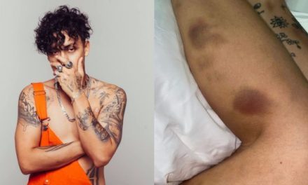 Novia del rapero Alemán exhibe pruebas de violencia contra ella en redes sociales