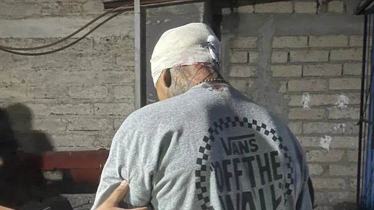 Lesionan a hombre con un martillo en la cabeza
