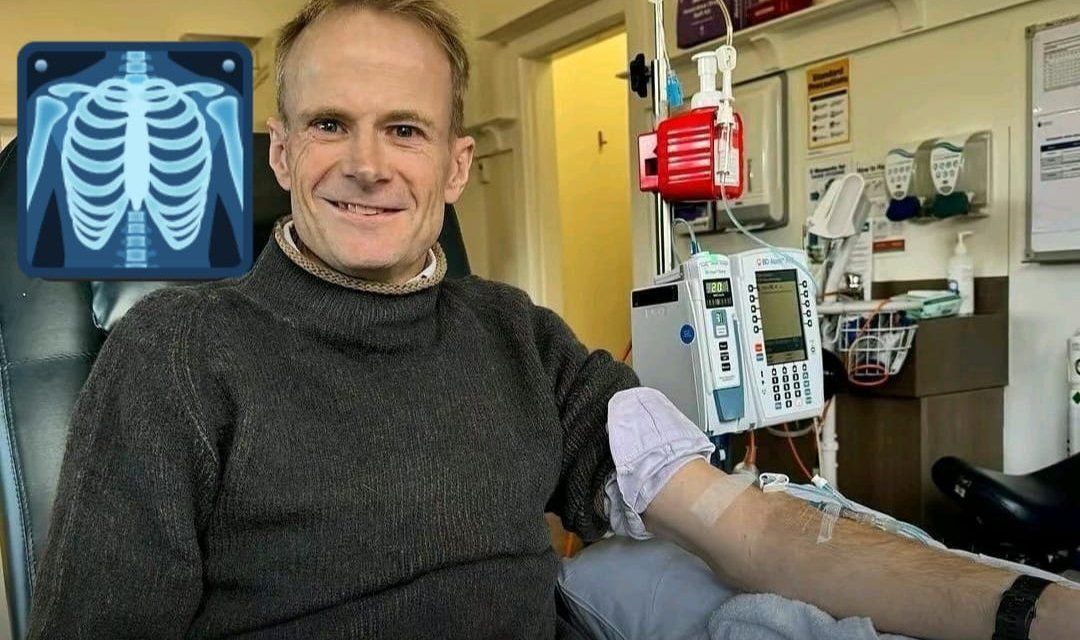 Médico australiano desarrolla tratamiento que lo salva de tumor cerebral terminal