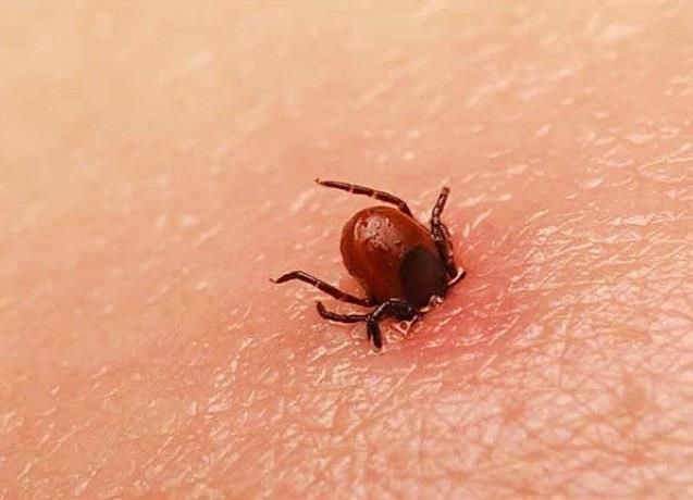 Se registra una muerte por rickettsia en la Región Sureste