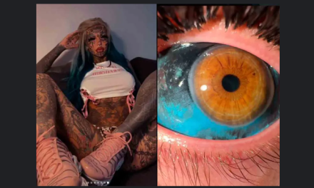 Influencer de tatuajes revela que se quedó ciega tras tatuarse los ojos