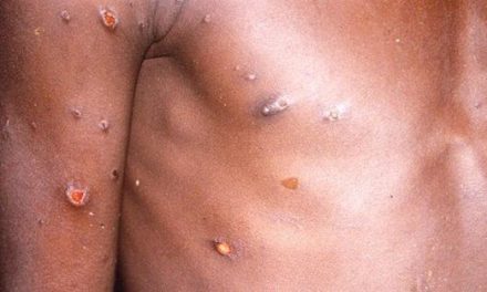 África declara emergencia de salud pública por rápida expansión de viruela del mono