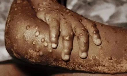 La OMS declara al mpox como una emergencia internacional de salud pública