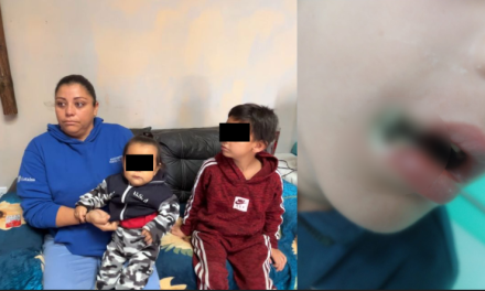 Yerik Daniel sufrió quemadura con un cargador de celular, su mamá pide apoyo a los saltillenses