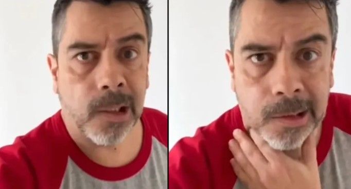 Carlitos Espejel aparece con parálisis facial… todo por culpa del estrés