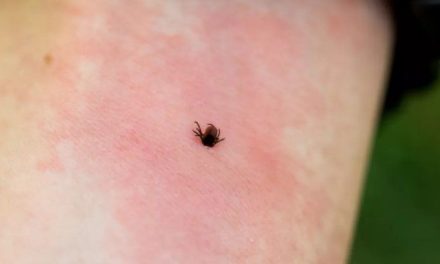 Disminuyen casos de dengue y rickettsia por las lluvias intensifican la fumigación