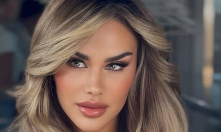 Ninel Conde se somete a una cirugía para cambiar el color de sus ojos
