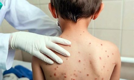 Alerta sanitaria en Jalisco: Investigan posible segunda muerte de bebé  por sarampión; suman 470 contagios